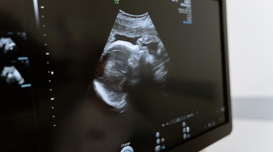 Kinderwunsch: Dein Körper und die Chancen auf eine Schwangerschaft